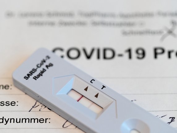 Le test de dépistage du coronavirus est simple et rapide à réaliser chez soi. Un résultat négatif n'est toutefois qu'un instantané. © KEYSTONE/GAETAN BALLY