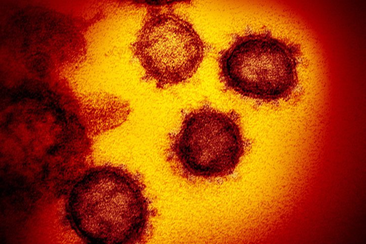 Les cas de coronavirus augmentent à nouveau fortement actuellement dans les régions peu vaccinées des Etats-Unis (archives). © KEYSTONE/EPA NATIONAL INSTITUTES OF HEALTH/NIAID- RML/NATIONAL INST