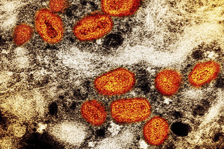 Le terme de variole du signe a été utilisé lorsque ce virus fut découvert en 1958 chez des singes dans un laboratoire au Danemark, mais le virus a été mis en évidence chez différentes espèces (archives). © KEYSTONE/AP